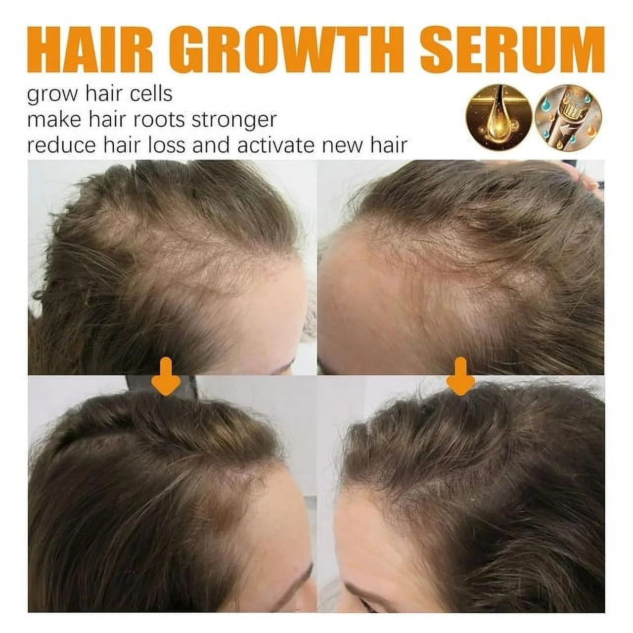 Biotin Hair Growth Spray, Biotin Hair Growth Serum, Biotin Thickening Herbal Serum, anti Hair Loss Serum for Women Men Hair Growth and Hair Loss