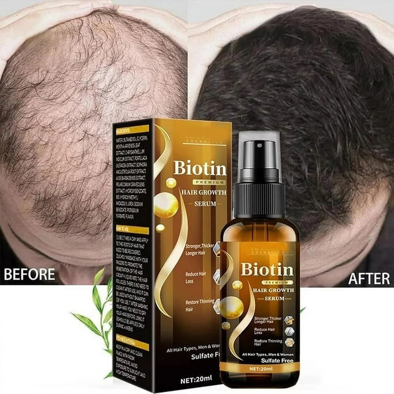 Biotin Hair Growth Spray, Biotin Hair Growth Serum, Biotin Thickening Herbal Serum, anti Hair Loss Serum for Women Men Hair Growth and Hair Loss