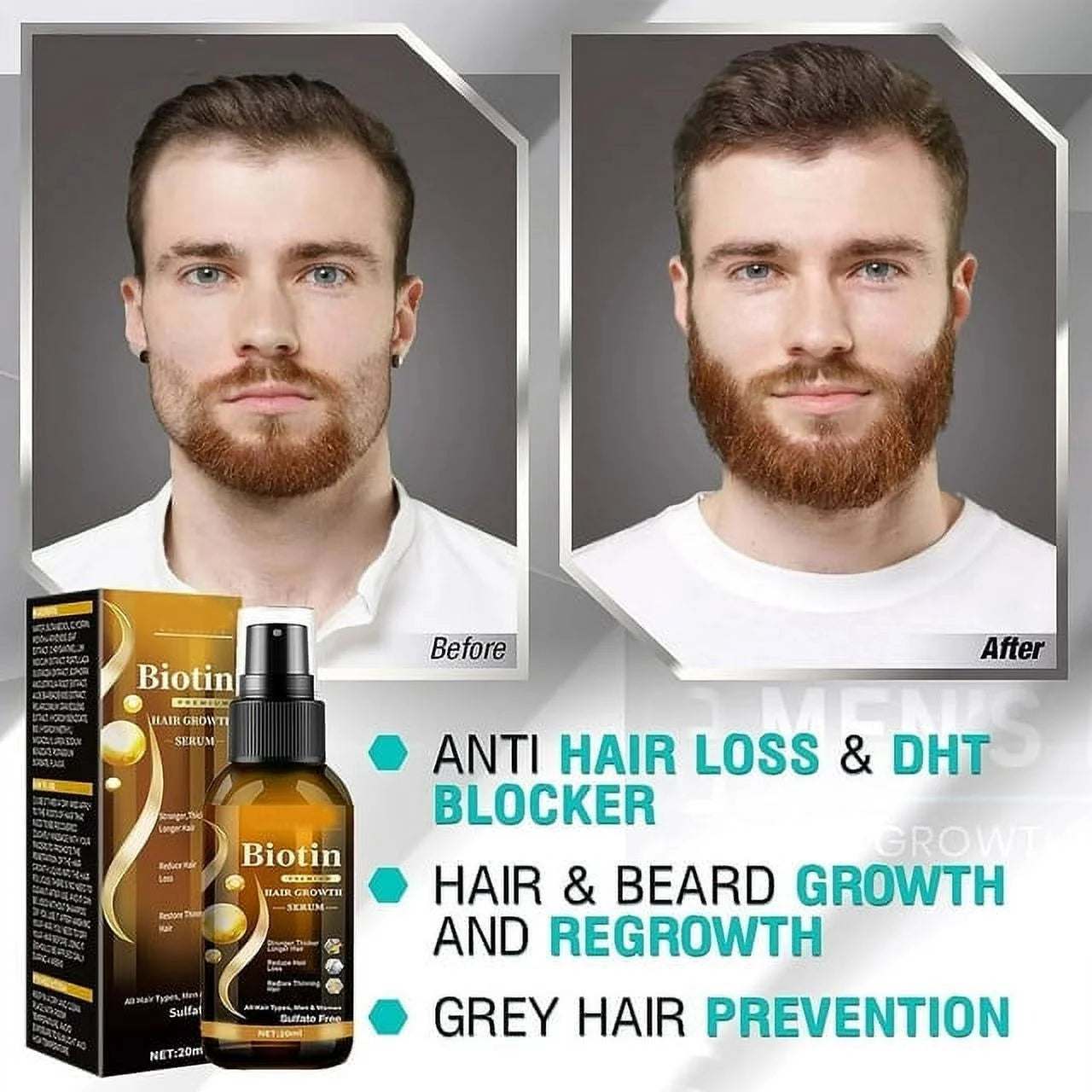 Biotin Hair Growth Spray, Biotin Hair Growth Serum, Biotin Thickening Herbal Serum, anti Hair Loss Serum for Women Men Hair Growth and Hair Loss