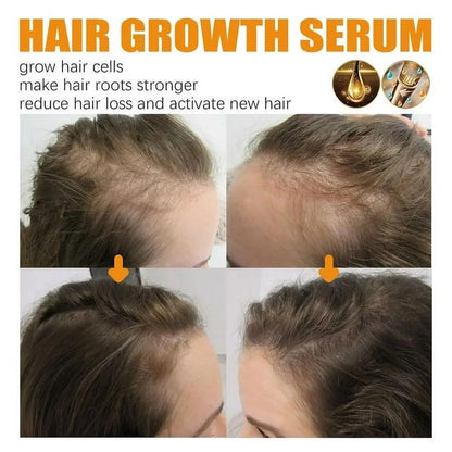 Biotin Hair Growth Spray, Biotin Hair Growth Serum, Biotin Thickening Herbal Serum, anti Hair Loss Serum for Women Men Hair Growth and Hair Loss