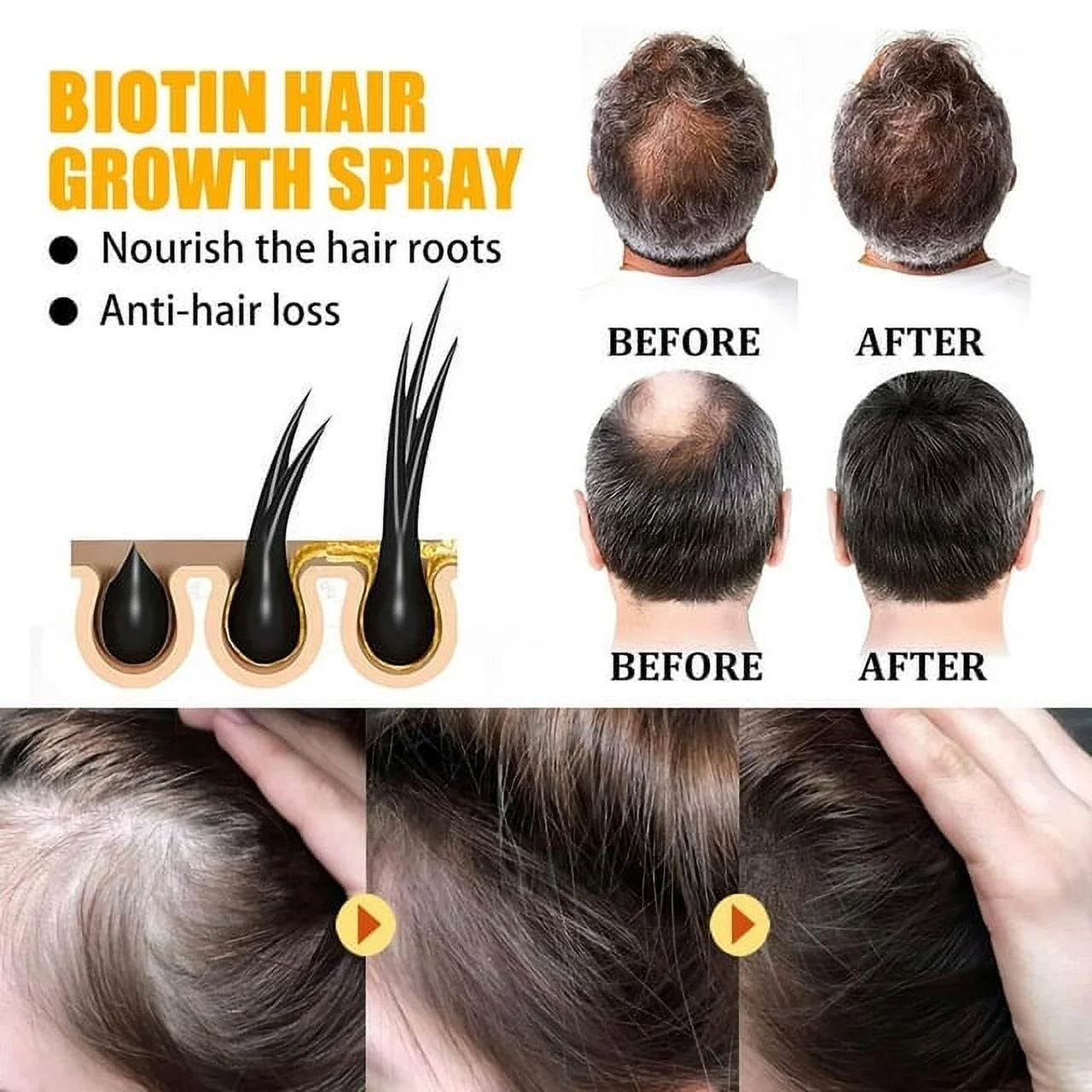 Biotin Hair Growth Spray, Biotin Hair Growth Serum, Biotin Thickening Herbal Serum, anti Hair Loss Serum for Women Men Hair Growth and Hair Loss