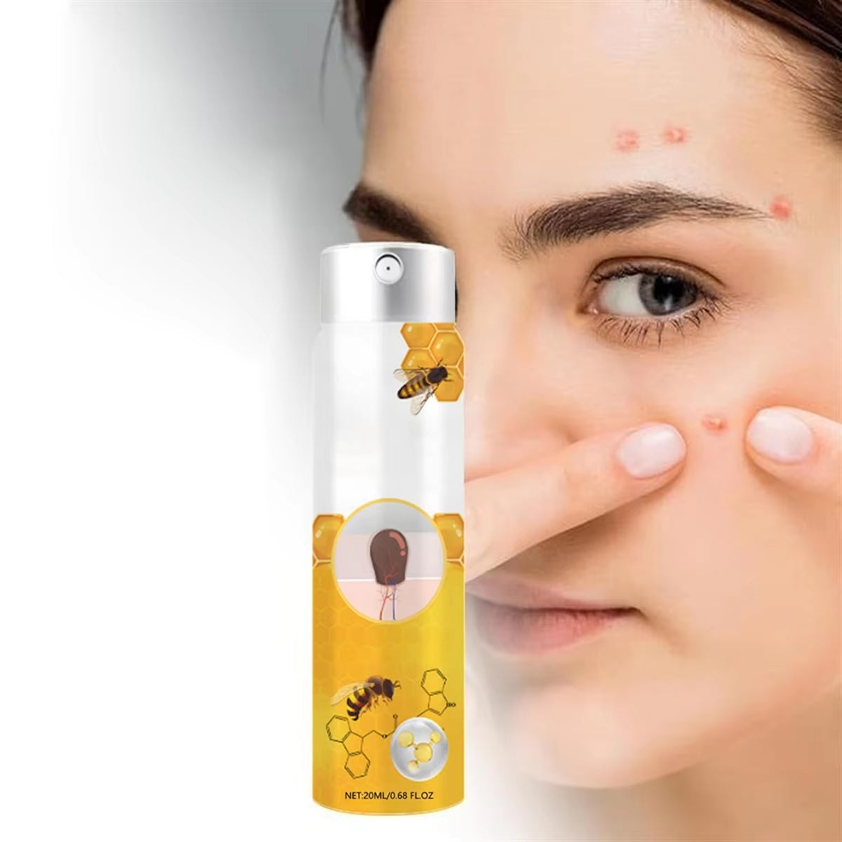 Stingaway™ Bee Sting Remover Granules – Fast-Acting Relief for Men & Women, Easy and Effective